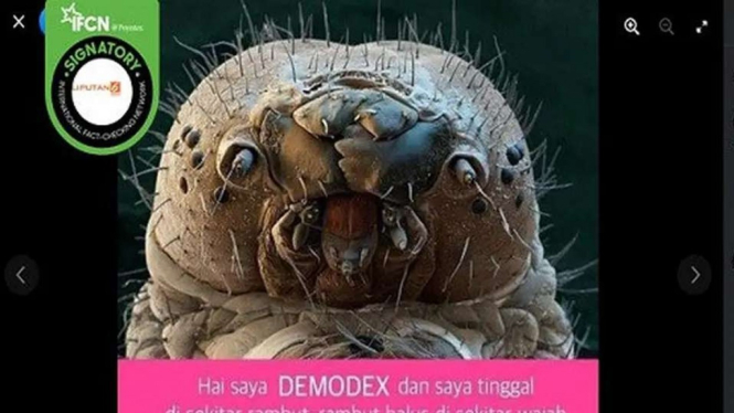 Cek Fakta: Penampakan Makhluk Mengerikan Demodex di Wajah Manusia