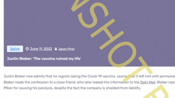 Cek Fakta: Justin Bieber Bilang Wajahnya Lumpuh akibat Vaksin COVID-19