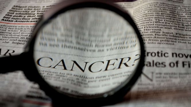 Bukan Lagi Penyakit Orangtua, Penderita Kanker di Usia Muda Meningkat 79 Persen
