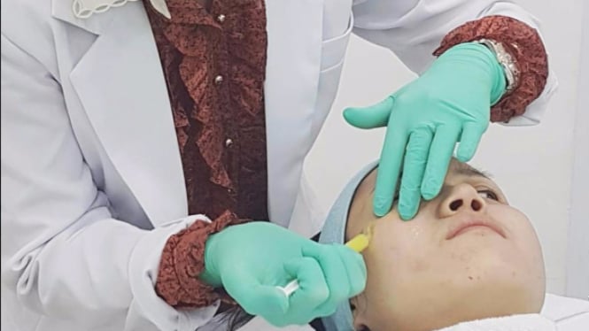 Mengenal Derma Roller dan Pentingnya Memilih Dokter Kecantikan yang Kompeten